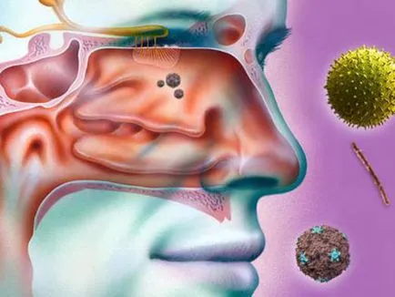 Vasotomy orrkagylócsontok mi ez okoz egy műveletet az alsó részén az orr és a fajta (a) Vasotomy orrkagylócsontok mi ez okoz egy műveletet az alsó része az orr és típusok