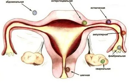 Látható ultrahanggal hogy méhen kívüli terhesség (látható) Akár látható ultrahang méhen kívüli terhesség