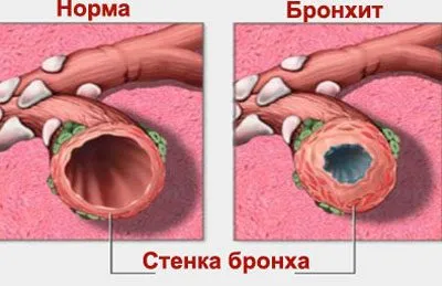 Hatása a nikotin az emberi test és felhasználásra károsodás (humán) A nikotin hatásának az emberi előnyök és ártalmak