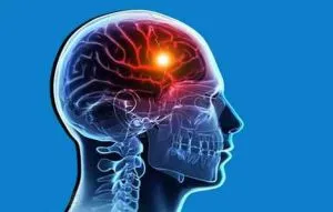 Helyreállítás a stroke otthoni körülmények között a beszéd, memória