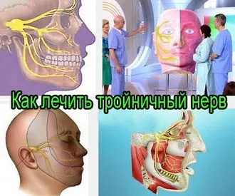Gyulladás a háromosztatú ideg népi orvosság - Ms - Női Megérzés