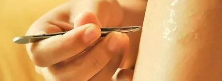 Benőtt szőrszál után szőrtelenítés, hogy megszabaduljon a problémát (megszabadulni) Benőtt szőrszál után szőrtelenítés, hogy megszabaduljon a probléma