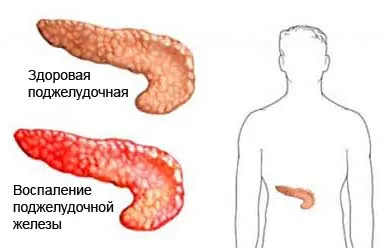 Betegségek kezelési, gyógyszerek