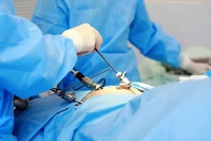 A kezelés után a eltávolítása endometrium polipok