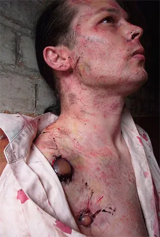 Бълхи в котки и кучета се предават на човека, ако това е вярно,