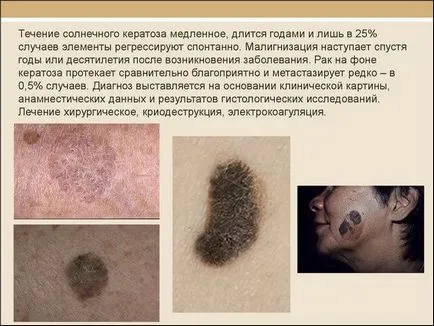 На лечение на раната у дома фото и видео (у дома) На лечение на раната у дома фото и видео