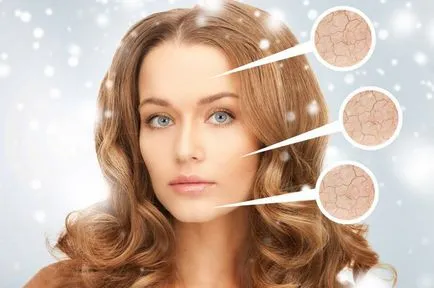 В подхранване на кожата през зимата рецепти дома на лицето маски, тайни за красота, здраве, аргументи и факти (грижа за кожата) В подхранване на кожата през зимата рецепти домашни маски за лице, тайни за красота, здраве, аргументи и факти