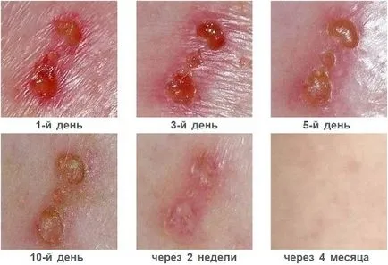 Какво ако раната тече прозрачна течност