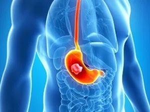 A kálium-permanganát oldattal, amelyhez A kálium-permanganát oldattal, amelyhez