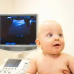 Hydrocephalic синдром хипертонична признаци и лечение smptomy заболяване