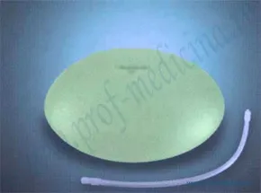 Гръдните импланти eurosilicone - размери директория, мнения (пълен с физиологичен разтвор) Гръдните импланти eurosilicone - размери директория, прегледи