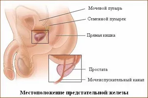 Какви лекарства за лечение на рак на простатата, облекчаване на аденом на няколко пъти по-бързо