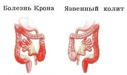 Как е ergography червата при възрастни и деца