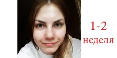 Hogyan erősít az orrsövény