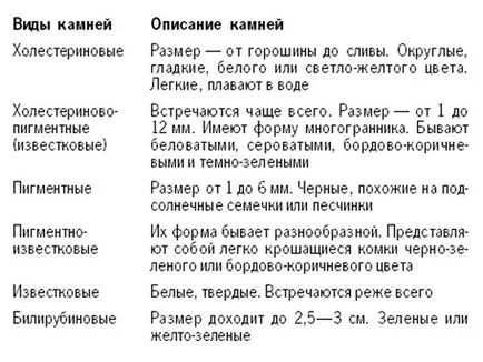 Камъни в симптомите на черния дроб, как да се разпорежда и лечение (симптоми) Камъни в жлъчката в симптомите на черния дроб, как да се отървете и лечение
