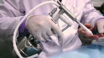 Cryospray