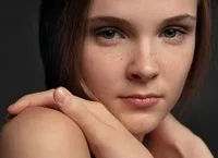 Лечението на пигментни петна по лицето и тялото - на причините, за лечение у дома