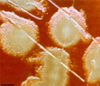 Лечение на Staphylococcus ауреус традиционните методи