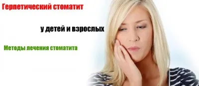 Лек за млечница в устата при възрастни, които са избрали