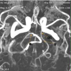 MRI експерт, г-н ангиография в изследването на мозъчните артерии