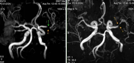MRI експерт, г-н ангиография в изследването на мозъчните артерии