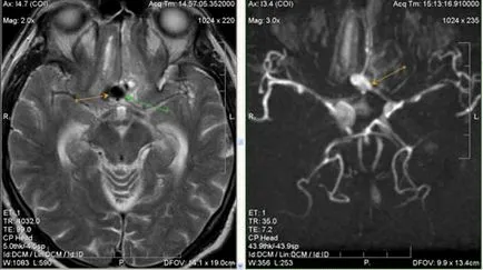 MRI експерт, г-н ангиография в изследването на мозъчните артерии