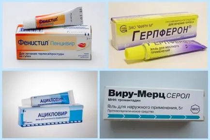 Херпес по устните, това е причина и лечение