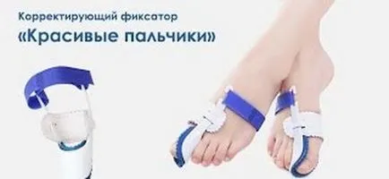 Ортопедични заключване корекция за крака - какво и къде да поръчате