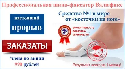 Ортопедични заключване корекция за крака - какво и къде да поръчате