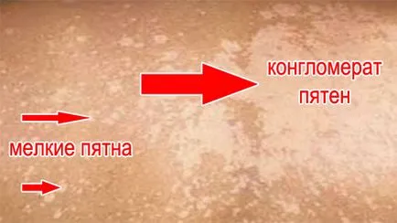 Pityriasis (многоцветни) Тения причини, симптоми, лечение