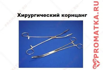 Плацента полип - Симптоми, Причини, Лечение