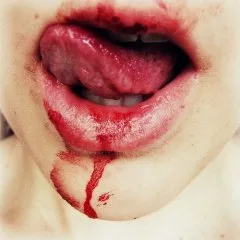 Защо не мога да се пие кръвта на (за пиене) Защо не мога да се пие кръвта на