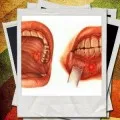 Зачервяване на окото правилното лечение у дома (око) Зачервяване на окото правилното лечение в домашни условия