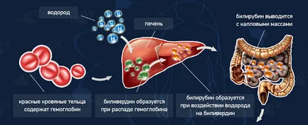 Повишаване на билирубина при новородени причини