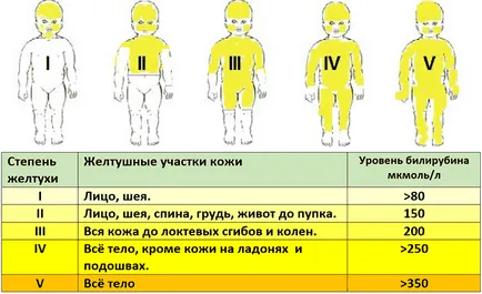 Повишаване на билирубина при новородени причини