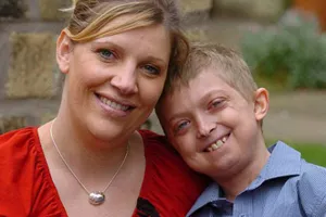 Progeria (Hutchinson-Гилфорд синдром) - заболяване, което поставя живота в 