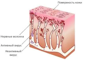Цветни лишеи са снимки на човека, симптоми и лечение
