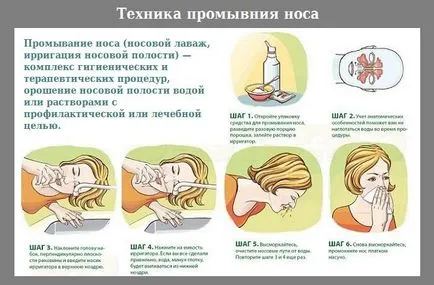 риновирус инфекция