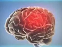 Кажи ми, какво се случва с човешкия мозък, когато тя е - полудява