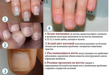 Ексфолирайте нокти причини и лечение, защо, трудно, какво да правя
