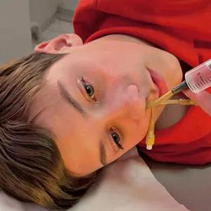 Hogyan mosson orrát sós Hogyan mosson orrát sós