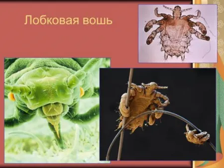 Pattanás fanszőrzet, hogy
