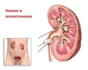 Доктор на името на бъбреците