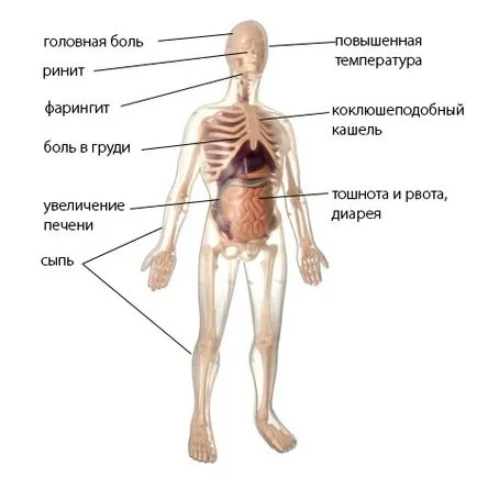 Какво е ТОРС