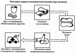 Какво да правите, ако изкълчен пръст