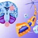 A tünet a sclerosis multiplex