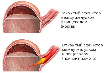 От това, което имате стомашни киселини