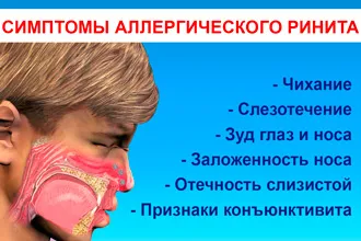 Как да се затопли носа Как да се затопли носа