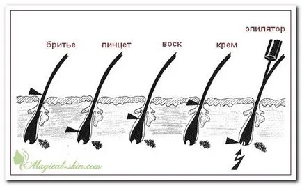 Как да се отървете от косата на корема