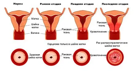 conization какво е